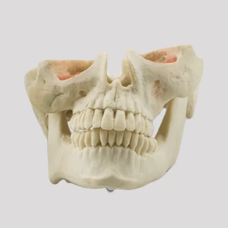 12789 - MANEQUIM COM ASSIMETRIA FACIAL SEVERA